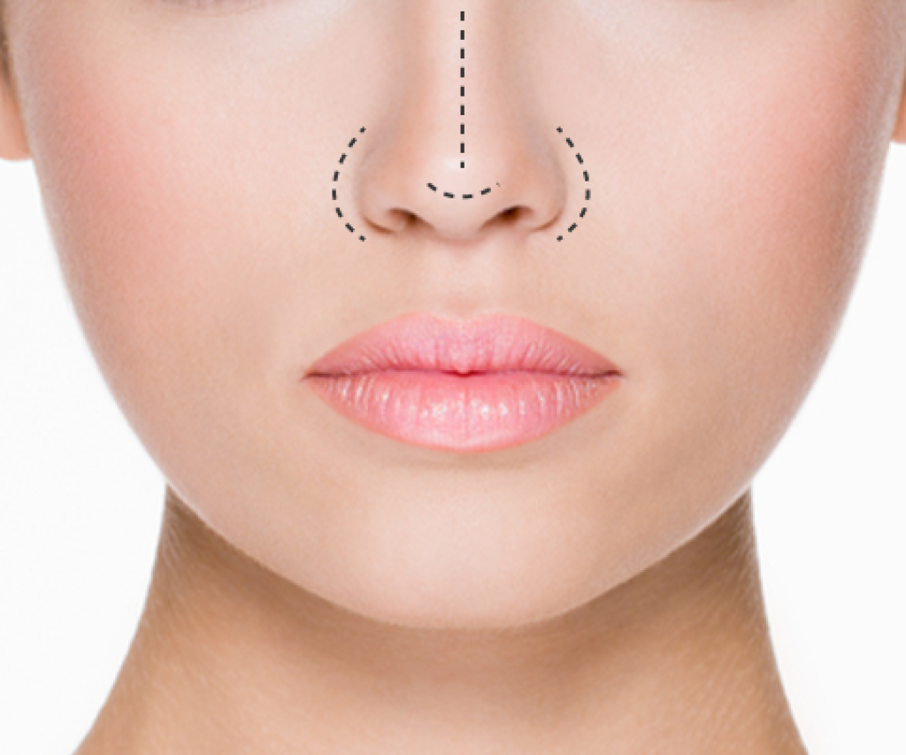 Nose Reshaping / Rhinoplasty